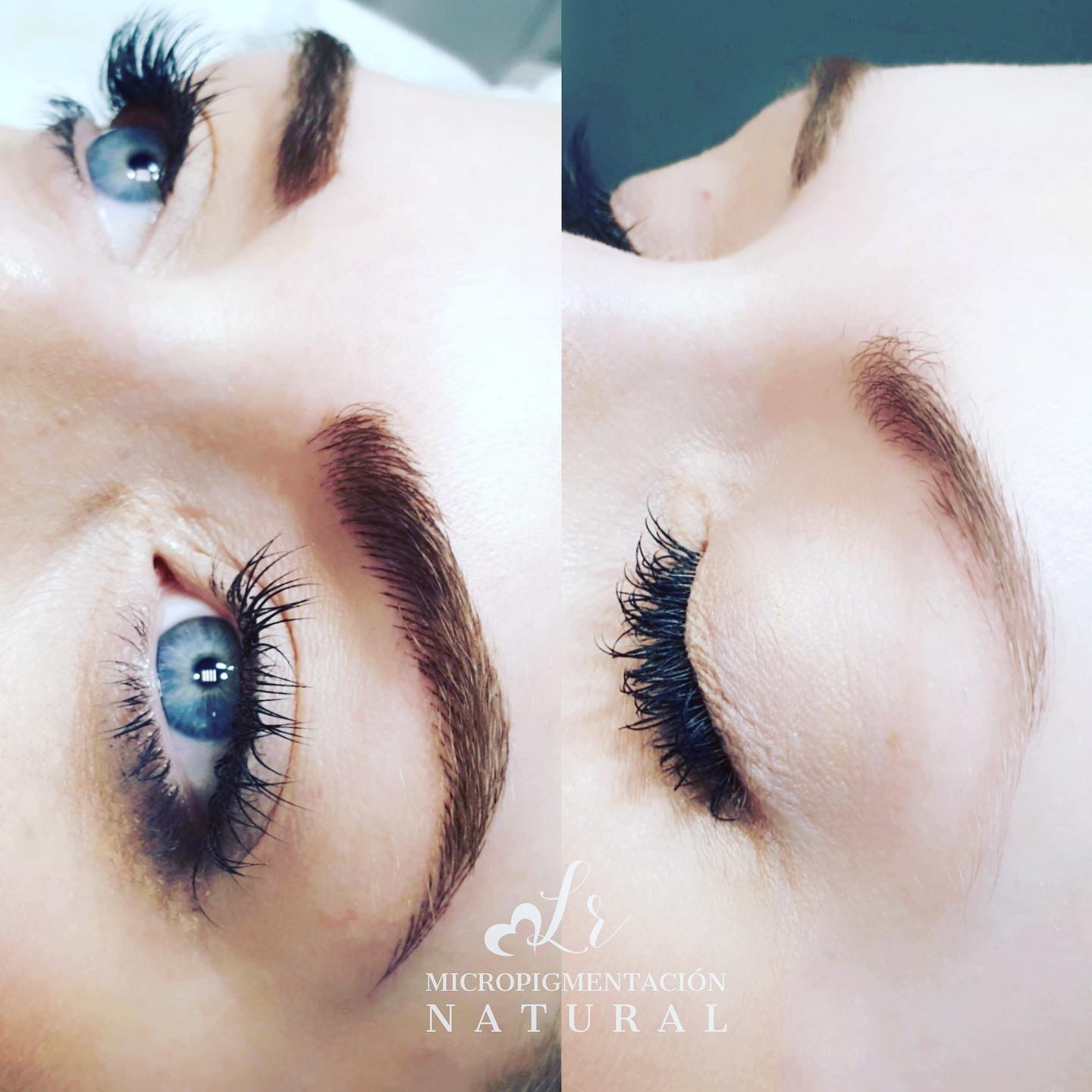 Rejuvenecimiento facial no invasivo en Amarilis Neves: belleza y bienestar sin cirugía