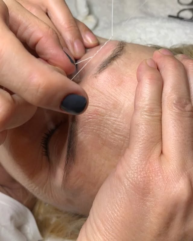 Micro-needling y rejuvenecimiento: estimula tu piel desde el interior